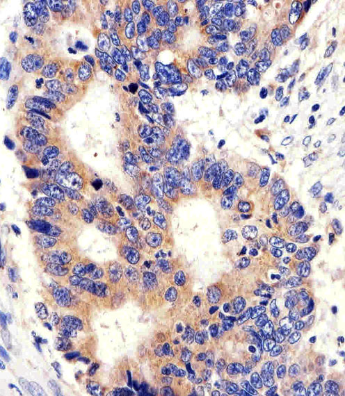 IHC-P - PCSK9 Antibody (C-term) AP7333b